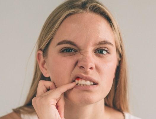 Woman with tooth abscess pointing to inflamed gum tissue