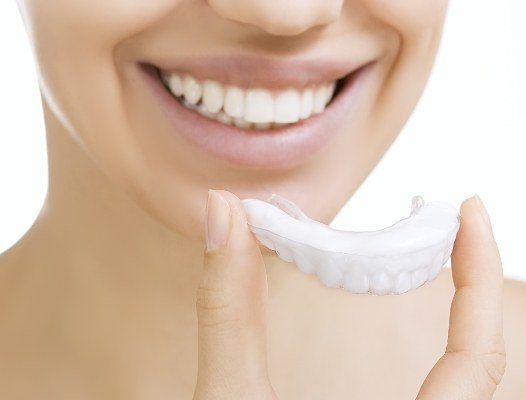 Woman placing at home teeth whitening application tray